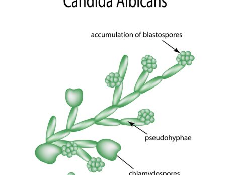 ketoconazolo galenico